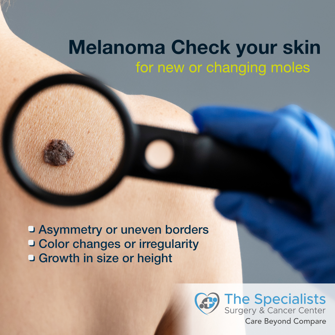 Melanoma: Check your skin for new or changing moles - The Specialists ...